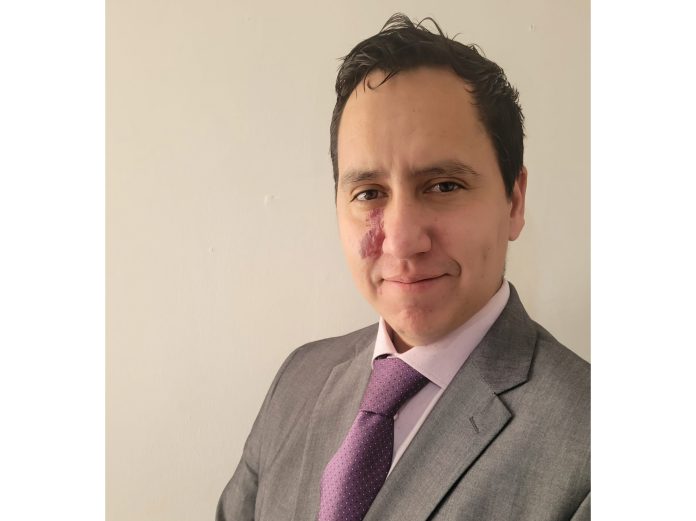 crawford affinity chile olivares pérez realidad expectativa póliza seguro diferencia